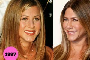 Celebrities who age ugly and ugly